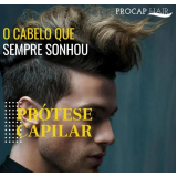Implante de Cabelo Masculino no ABC Implante de Cabelo Masculino no ABC