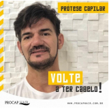Manutenção de Prótese Capilar Masculina Manutenção de Prótese Capilar Masculina