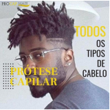 Manutenção para Prótese Capilar de Silicone Masculina Manutenção para Prótese Capilar de Silicone Masculina