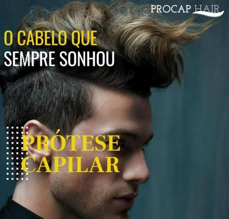 Onde encontrar Tratamento para calvice masculina no Morumbi