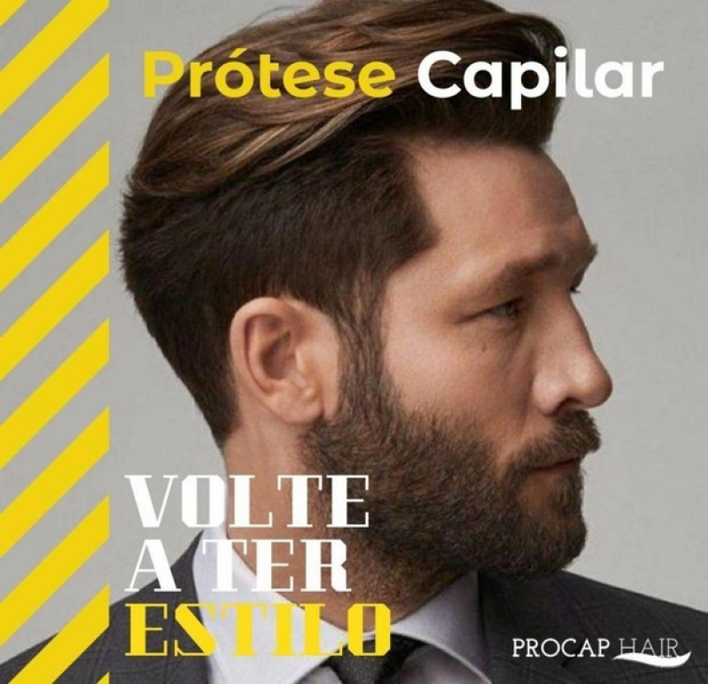 Onde fazer Próteses capilares masculinas em Itaquaquecetuba Onde fazer Próteses capilares masculinas em Itaquaquecetuba