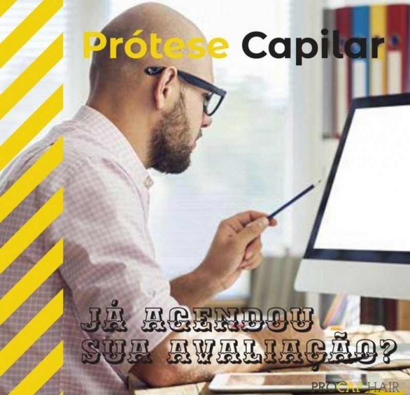 Preço para fazer Prótese capilar para homens em Ilha Comprida Preço para fazer Prótese capilar para homens em Ilha Comprida