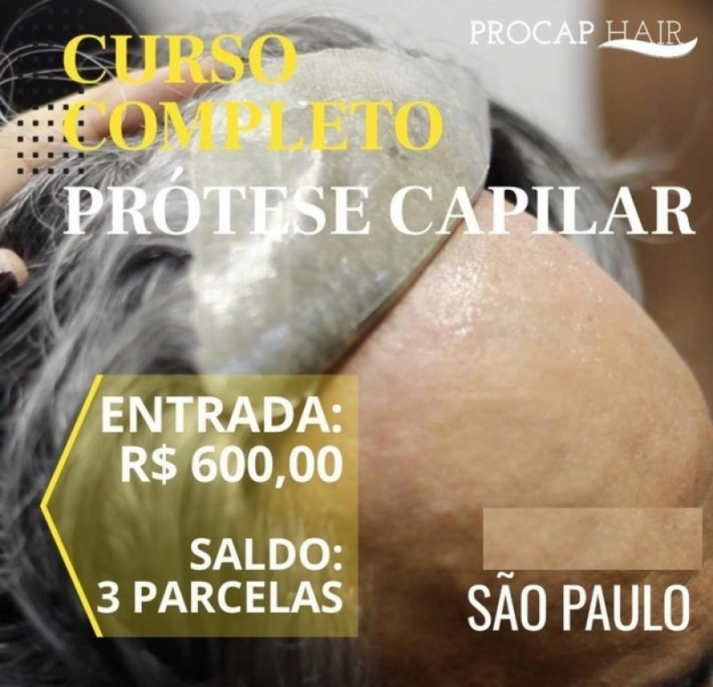 prótese capilar masculina com tela em Juquitiba prótese capilar masculina com tela em Juquitiba