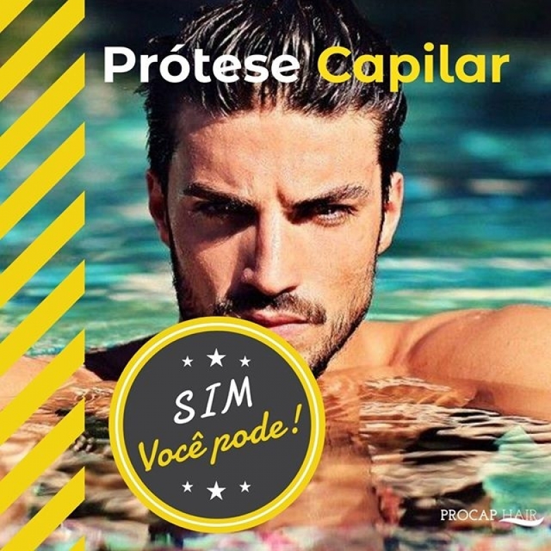 Prótese capilar valor em Peruíbe Prótese capilar valor em Peruíbe