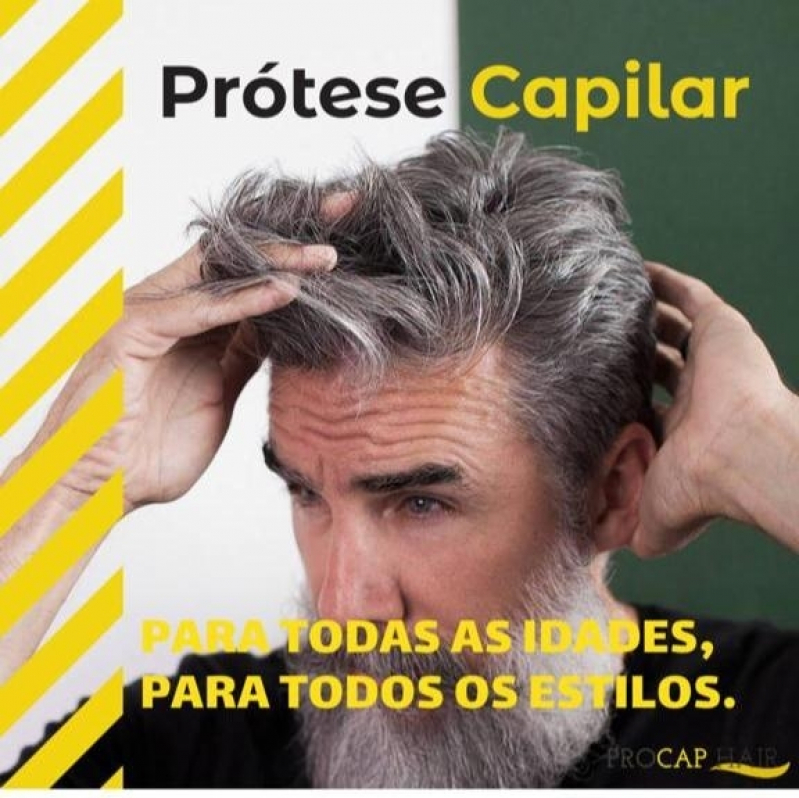 próteses capilar para alopecia masculina em São Vicente próteses capilar para alopecia masculina em São Vicente