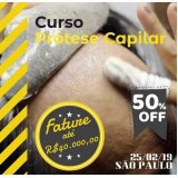 Prótese Capilar Micropele Feminina Prótese Capilar Micropele Feminina