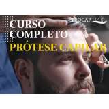 Prótese Capilar em Barueri Prótese Capilar em Barueri