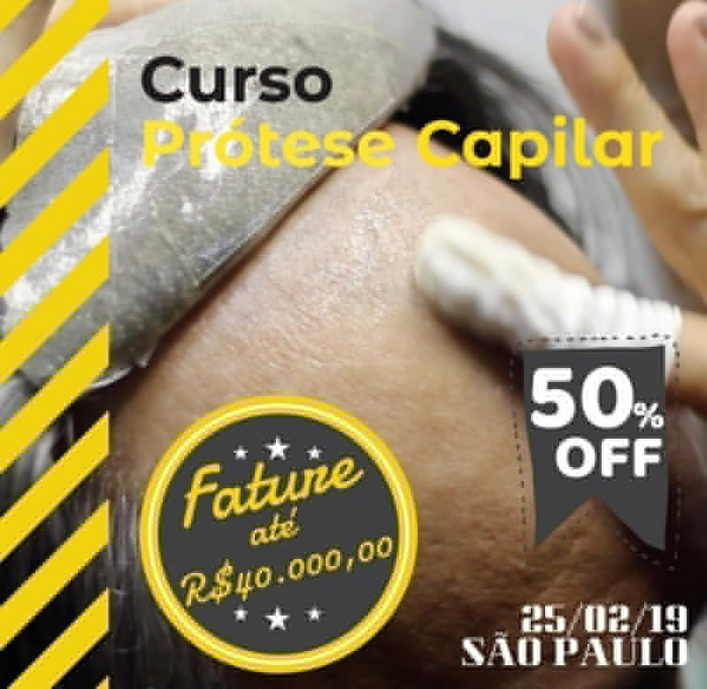 Quanto custa Prótese capilar no Embu das Artes Quanto custa Prótese capilar no Embu das Artes