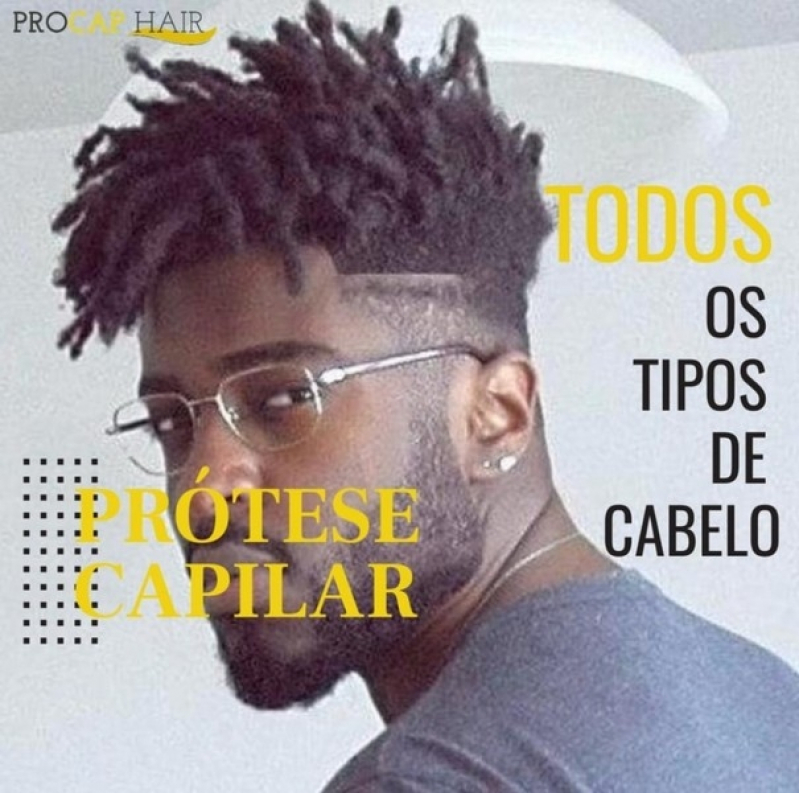 Valor Próteses capilares masculinas no Socorro Valor Próteses capilares masculinas no Socorro
